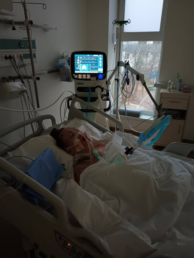 Фото Вероніки Романюк із реанімації станом на 24.02.2023